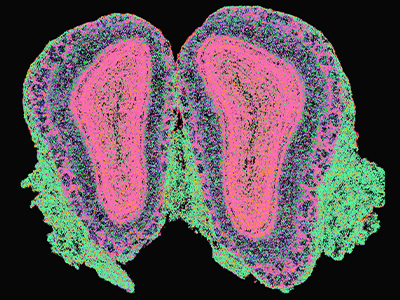 空间多组学分析