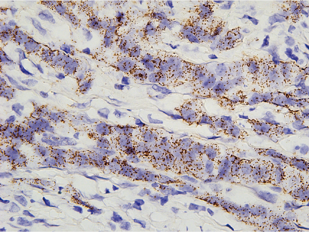 单分子RNA显色原位杂交（smCISH）
